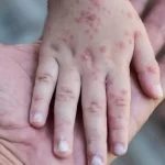 Ömer Çelik’ten Netanyahu’ya tepki: Tarihin vicdanı tarafından mahkum edilmiş biridir – Birlik Haber Ajansı